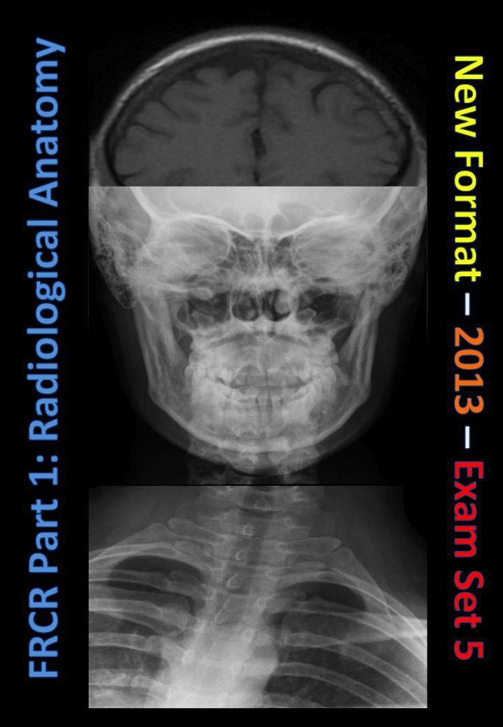 FRCR Part 1_ Radiological Anatomy - New for 2013 - Set 05