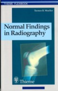 Normal Findings in Radiography