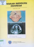 Majalah Radiologi Indonesia Tahun VII no.2 /1999
