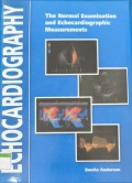 Echocardiography