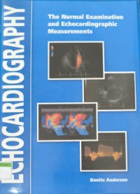 Echocardiography