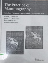 The Practice of Mammography