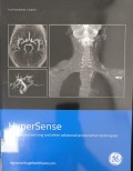 HyperSense