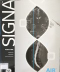 SIGNA Pulse of MR Autum 2019