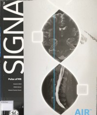 SIGNA Pulse of MR Autum 2019