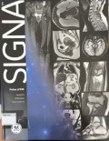 SIGNA Pulse of MR Spring 2019