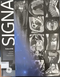 SIGNA Pulse of MR Spring 2019