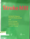 Stroke MRI
